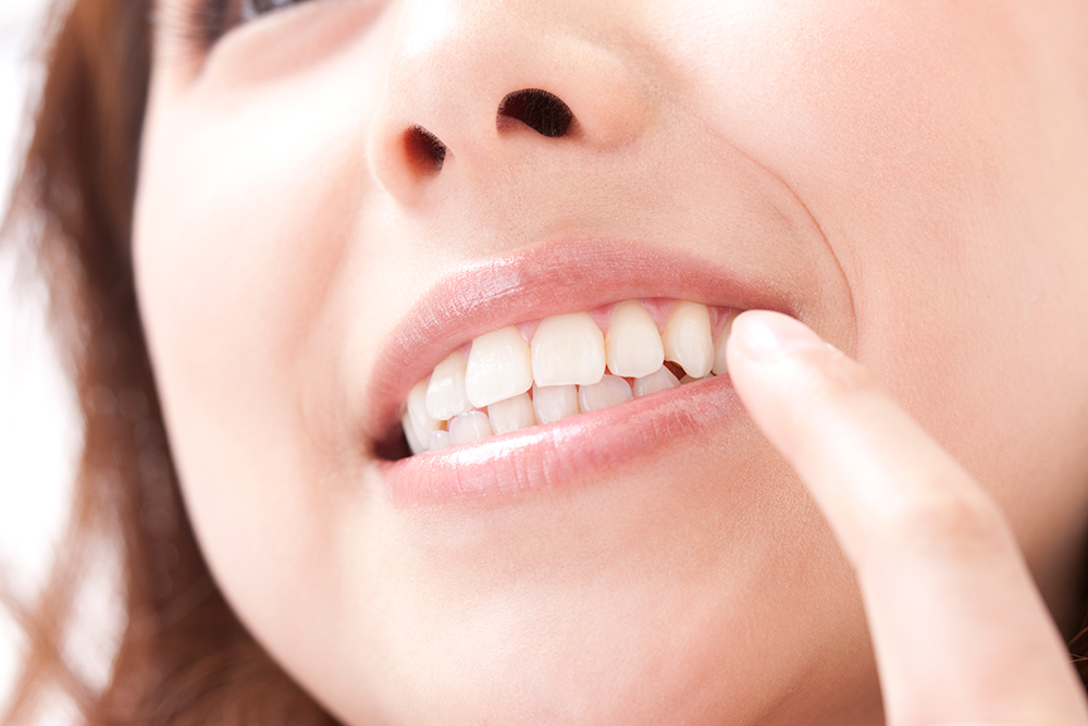 ホワイトニングの効果を確認